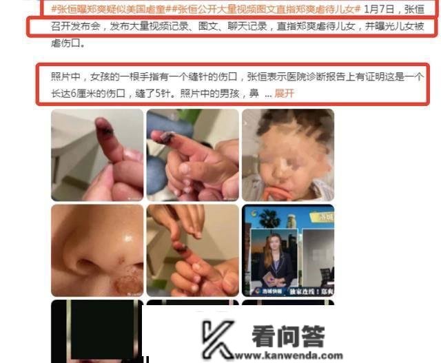 张恒爆料郑爽虐儿，申请美国贫苦白卡，孩子受伤照片曝光