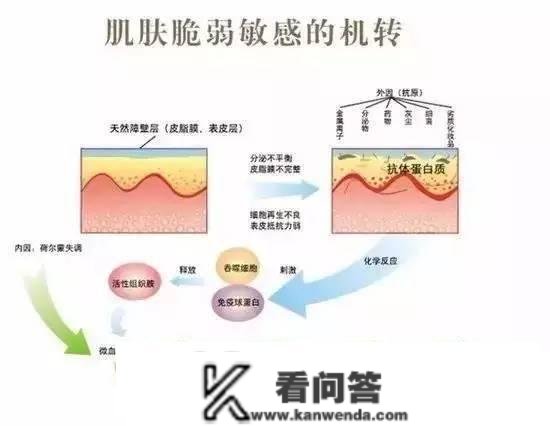 什么是干敏？什么是油敏？什么是激素敏？？