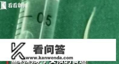 3岁宝宝异物卡喉，医生感慨：父母的两个判断处置，救了孩子一命