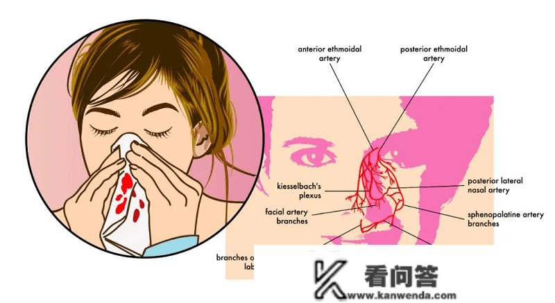 “医生，我鼻子出血啦”