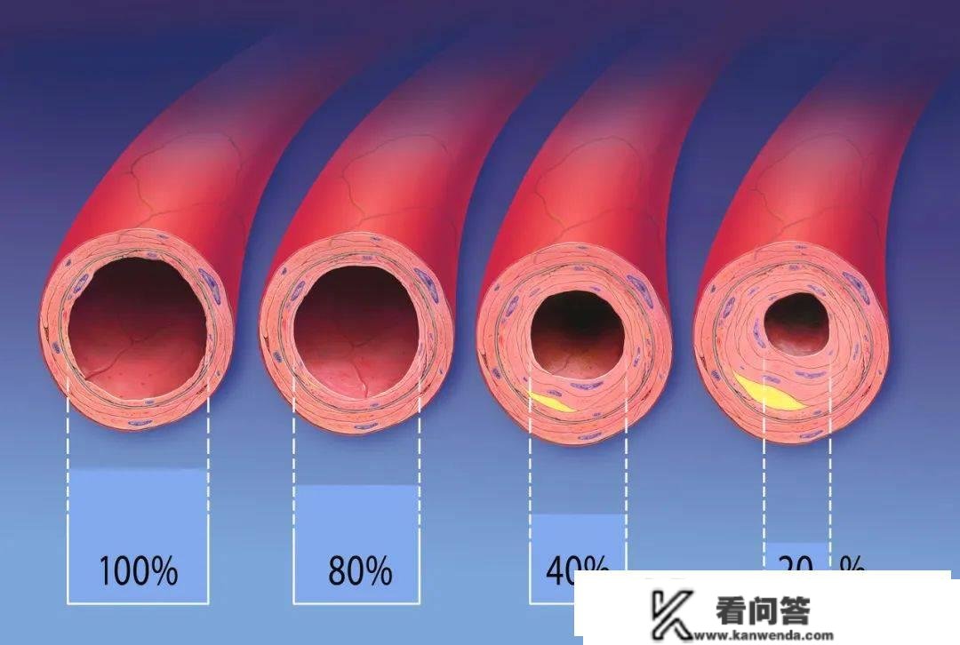 血脂查抄成果一般，是不是实的能够停药？