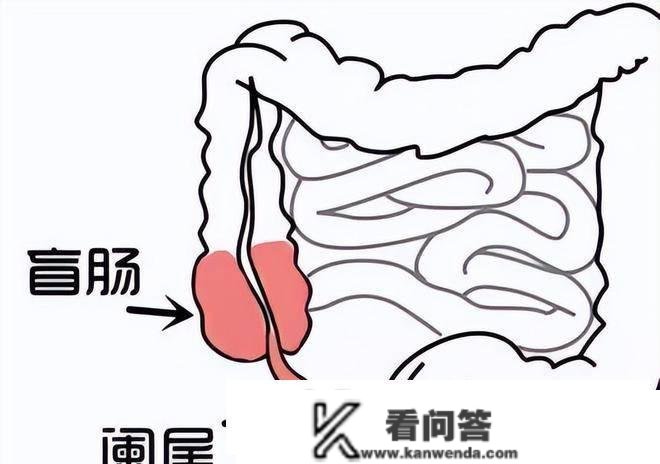 人体有6个器官能够“拿掉”，不会影响一般生活，是不是实的？