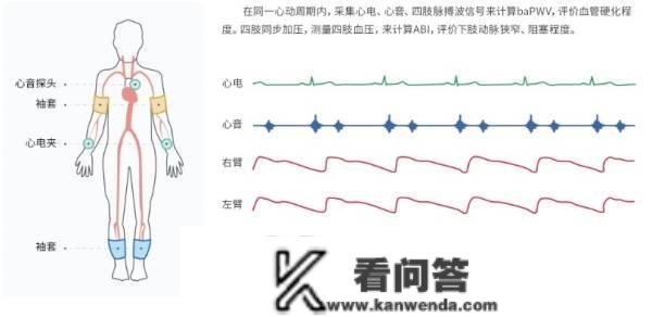 动脉硬化检测仪设备丈量人体动脉阻塞