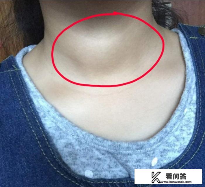 甲状腺如何检查