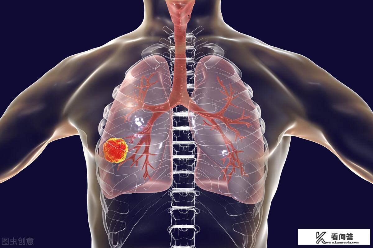 肺上小结节是怎么回事