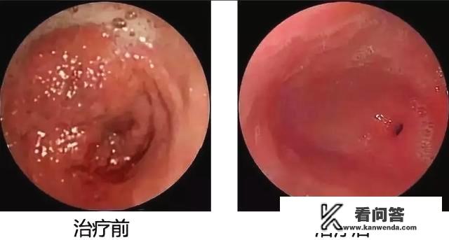 肚子饿了就疼是怎么回事？