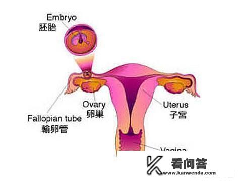 多久B超能检测出是宫内还是宫外孕？