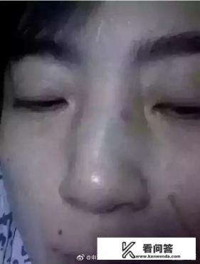 如何看待曾经将医生打成骨折、尿失禁的老师，评上高级职称？