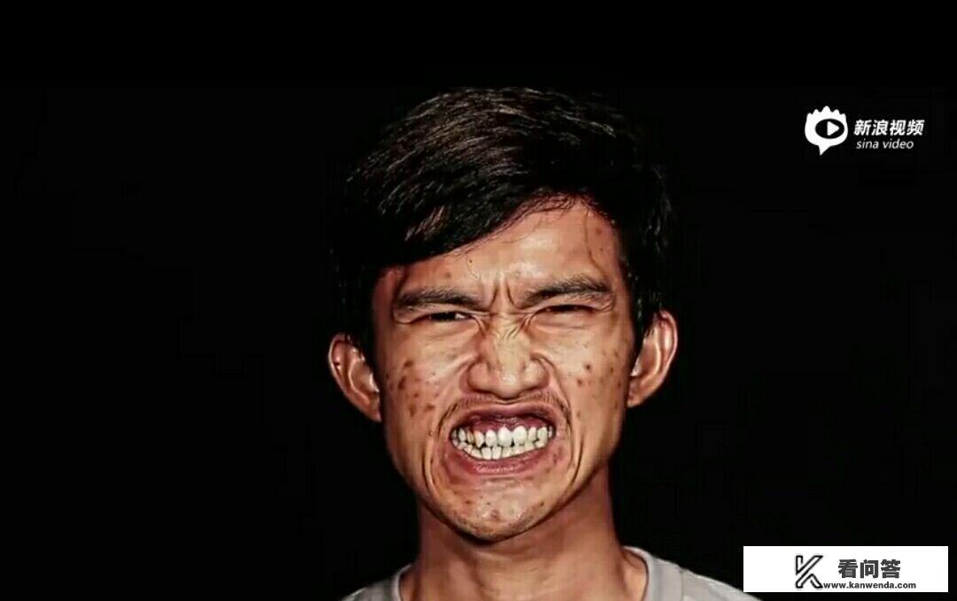 最近网上泰国一个小伙子去韩国整容成功？你怎么看？