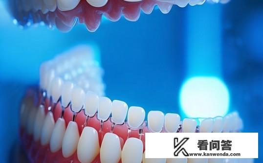 牙齿矫正用OBrace球面自锁托槽，费用如何？OBrace球面自锁托槽，牙齿矫正费用详解