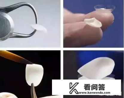 牙齿贴片用几号色自然？